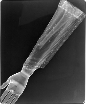 X-ray of the Arm Reliquary of the Apostles